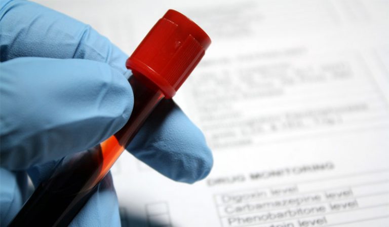 What blood tests are used to determine your growth hormone levels?