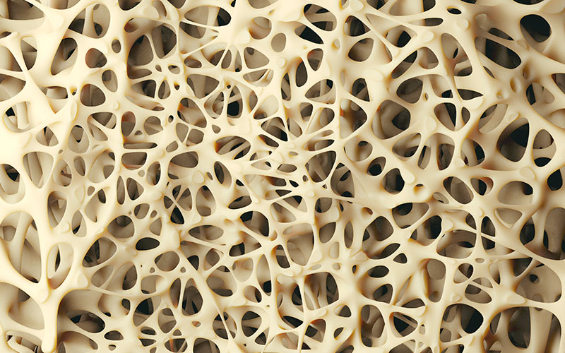 What are the Causes of Osteoporosis